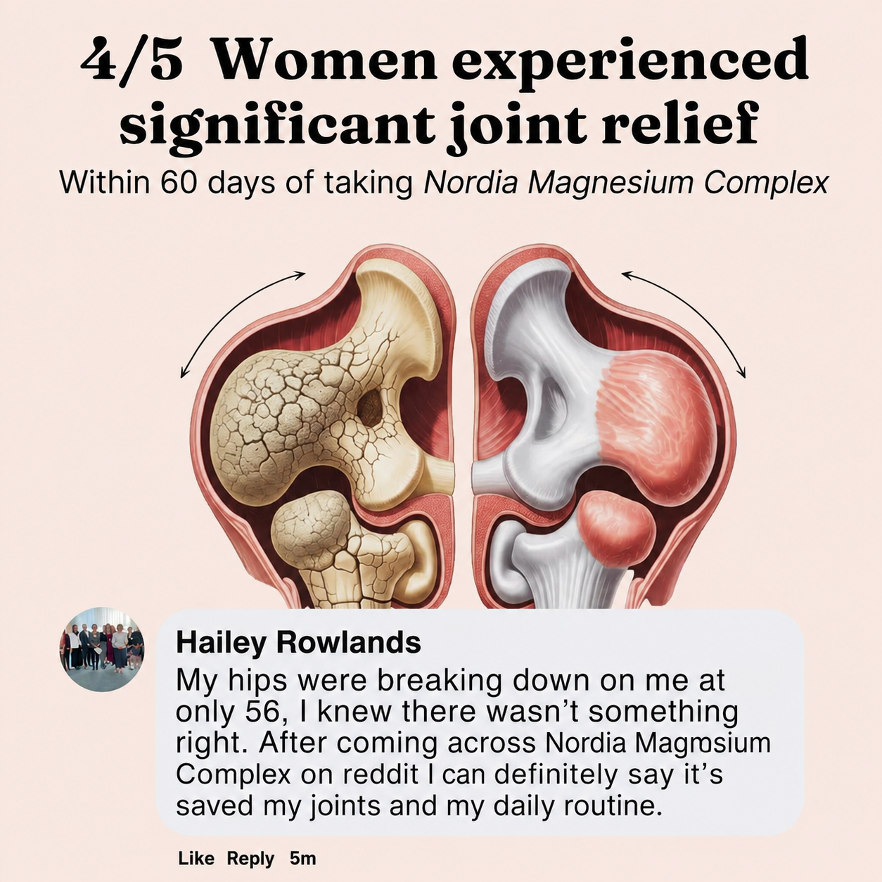Norida Magnesium Complex — Hip & Glute Relief